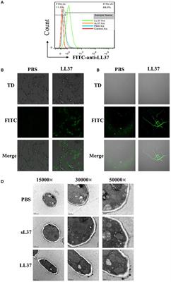 LL37 Inhibits Aspergillus fumigatus Infection via Directly Binding to the Fungus and Preventing Excessive Inflammation